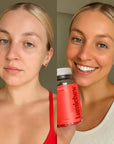 Lumichew Radiance+ Gummies