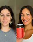 Lumichew Radiance+ Gummies